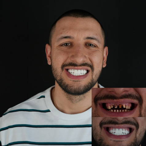 Patient Experiences 2