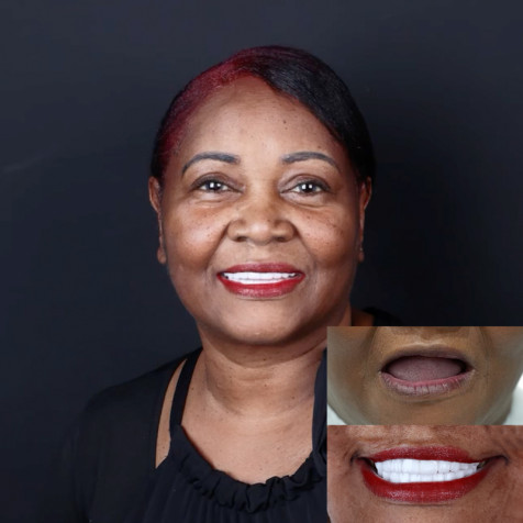 Patient Experiences 8